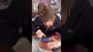What is Pixel RF Microneedling?