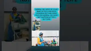 normal delivery story after 2 c sections,yes it's possible normal delivery after 1 or 2 c sections..