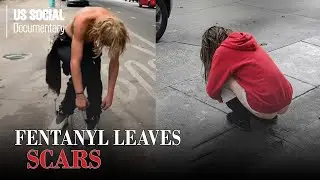 Fentanyl Leaves Scars: Homeless in America and The Pain That Can't be Healed - Documentary