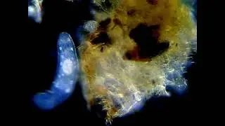 Stenostomum - Dark field illumination
