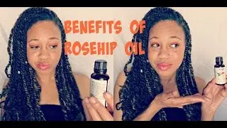 3 Minutes The Benefits of Rosehip Oil #3minwed | Eunycemari