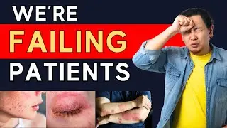 Eczema Causes + Hidden Triggers (And Why It&rsquo;s NOT Genetic) | Dr. Ian Myles
