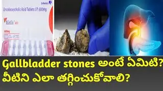 Bilefix tablets uses and side effects in telugu.Best tablets for cholesterol control in liver.