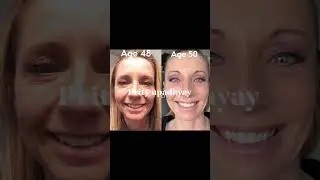 #liquidcollagen #collagenresults #moderecollagen