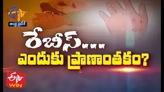 Why Rabies Life Threat?| Sukhibhava | 28th September 2022 | Full Episode | ETV AP
