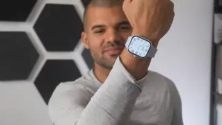 Xiaomi Redmi Watch 5 (review) l Beste Smartwatch UNTER 100&euro; ?