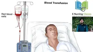 BLOOD TRANSFUSION PART 2 #BLOODTRANSFUSION#BSCNURSING#NURSINGCLASS  #MEDICALSHORTS CREDIT:- SUNILSIR