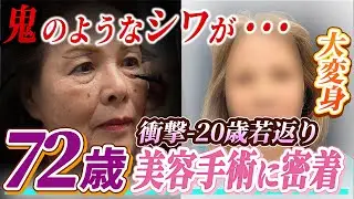 【密着】70代の美の再挑戦！美しさを諦めない生き方が素晴らしすぎた...！#70代 #美容整形 #整形 #たるみ