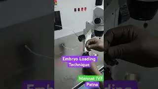 IVF me embryos load kaise hote hain #embryotransfer @ Mannat IVF Patna #patnaivf