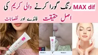 Maxdif Is A Great Night Cream For Bright & Even Skin Tone | max dif Cream review | Remedy Clinic