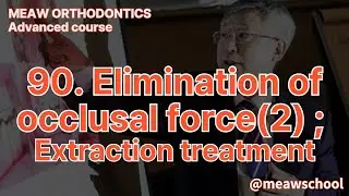 90.Elimination of occlusal force (2) - extraction treatment