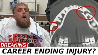 BREAKING: Jake Paul LOSES 7 TEETH, JAW BROKEN in 2 Places After Anthony Joshua FIGHT