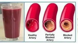 Aanar kay juice ka faida! #pomegranate #bloodcomposition #arteries #redbloodcells #whitebloodcells