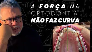 COMO CORRIGIR O DESVIO DE LINHA MÉDIA | A FORÇA NA ORTODONTIA NÃO FAZ CURVA 🤔