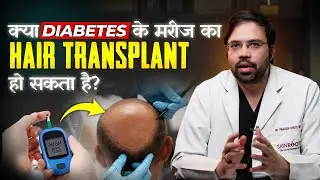 Is Hair Transplant Safe in Diabetes? A Complete Guide | Can Diabetics Get a Safe Hair Transplant |