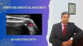 How to predict Fetal Pulmonary Maturity - Epiphysis