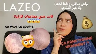 &Eacute;pilation d&eacute;finitive chez Lazeo : Ce qui m&rsquo;est arriv&eacute; va vous surprendre !🤯وداعاً للشعر الزائد للأبد