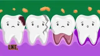 Tooth decay Rife Healing Frequency-Repair Teeth and Gums-Teeth and Gums Regeneration