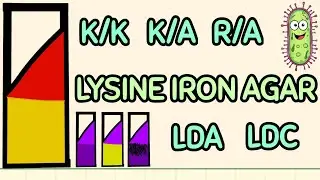 Lysine Iron Agar (LIA) Test Simplified | for MedTech Students