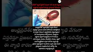 ​ఏపీలో స్క్రబ్ టైఫస్ పంజా: 20 మంది మృతి, చిత్తూరు జిల్లాలో రికార్డు స్థాయిలో కేసులు! #trending #news