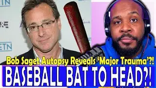 REVEALED! Bob Saget Autopsy Shows SEVERE Head Trauma 'Like He Had Been Hit By BASEBALL BAT'?!