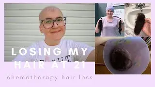 Losing my hair at 21: Chemotherapy hair loss, my experience (my cancer journey)