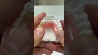 More teeth retention!