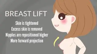 How To Choose Between Breast Augmentation And Breast Lift Surgery In Virginia Beach
