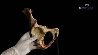 131. Lower limb hip bone