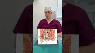 Как лучше удалять геморрой? На вопрос отвечает врач проктолог нашего центра Александр Николаевич.