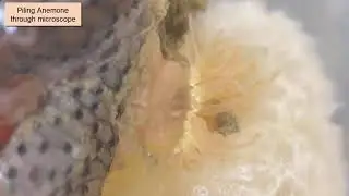 Piling Anemone