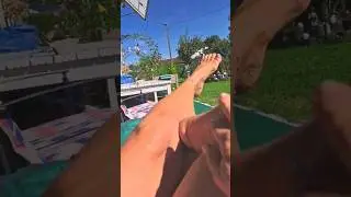 amputee bk #amputationjourney #fashion#artificiallimb #stumping #viralvideo#coto#foot#viral
