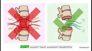 Over 50? Sciatica Pain? Stop Stretching! Do This 