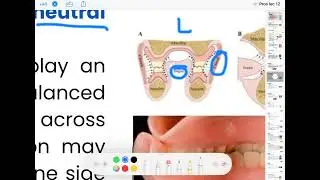 Prosthodontics 5th lec 12 Stability and support of complete denture 💙