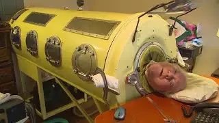 Человек, который жил с аппаратом искусственного дыхания: Пол Александр умер в возрасте 78 лет