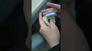 Diagnostic Wax Up Putty