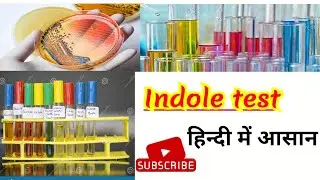 Indole test, microbiology || Bacterial identification in hindi