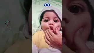 #cutebaby #big eye baby #youbaohezu challenge 👀