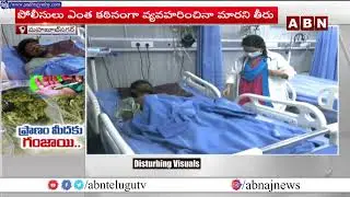 DR VIVEK SAGAR PALLEPAGU || Dr Vivek&rsquo;s gastro liver and endoscopy centre MBNR 