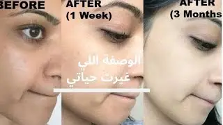 وداعا لمشاكل البشرة لوجه كالمرآة …روتين بسيط في ثلاث خطوات ..سر اطباء الجلد