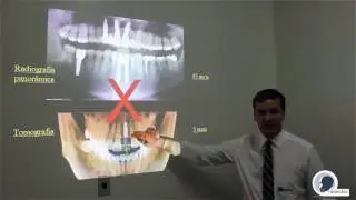 Radiografia Panorâmica x Tomografia - Radiodoc