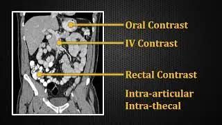 Introduction to Contrast Enhacement: Computed tomography (CT) explained