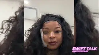 Chrisean Rock BREAKS Down While Removing Blueface Face Tattoo