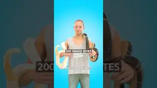 Man Injects Snake Venom On Purpose 😳 Surgeon Reacts