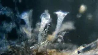 Stentor - Trumpet Animalcules | Unicellular Organism | Wonder World