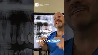 🦷 Bridge vs. Implant &mdash; What&rsquo;s REALLY Best for Your Smile? 🤔