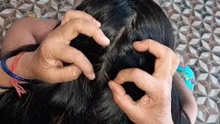 TRADITIONAL NITPICKING LICE EGGS | HEAD LICE NITPICKING LONG HAIR | ASMR NIT PICKING LOTS OF LICE