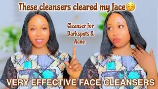 THESE FACE CLEANSERS WILL CLEAR ALL YOUR DARK SPOTS & ACNE| Best face cleansers for glowing skin