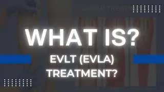 What Is EVLT / EVLA? Laser Treatment for Varicose Veins Explained