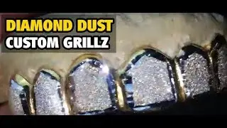 Diamond Dust 2-Tone Custom Gold Teeth Grillz! - BlingCartel.com